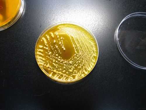 大肠杆菌会在木板上生长么（大肠杆菌会在木板上生长么吗）-图3